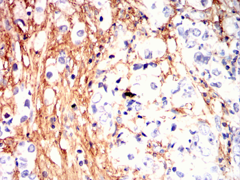 GRIA2 Antibody