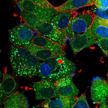 ARHGDIA Antibody