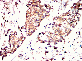 INCENP Antibody