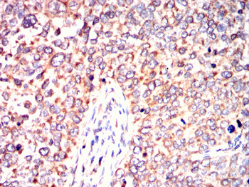 INCENP Antibody