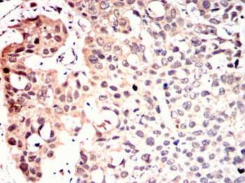INCENP Antibody