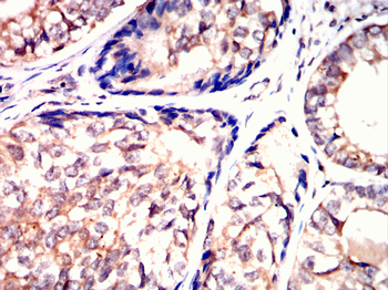 INCENP Antibody