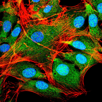 CSNK2A2 Antibody