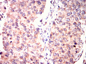 CSNK2A2 Antibody