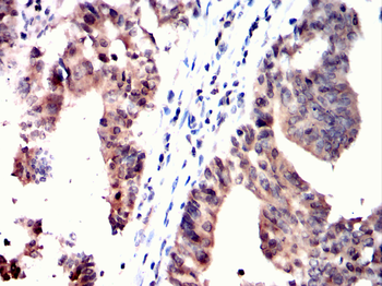 CSNK2A2 Antibody