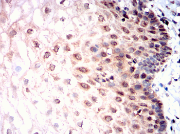 CSNK2A2 Antibody