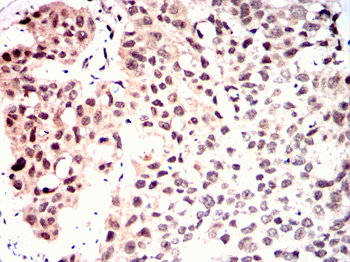 CSNK2A2 Antibody