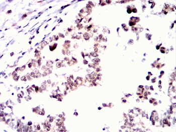 CSNK2A2 Antibody
