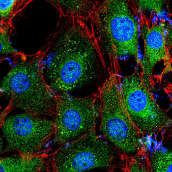 PDE1B Antibody