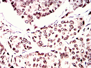 GATA6 Antibody