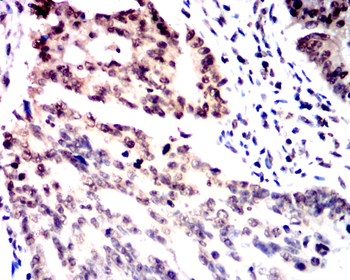 SMAD1/5/9 Antibody