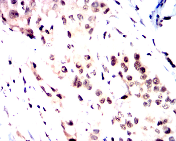 TWIST1 Antibody