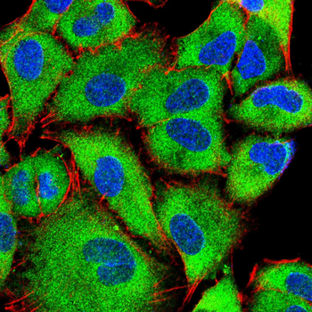 TBK1 Antibody
