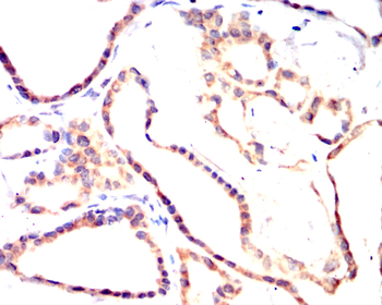 TBK1 Antibody