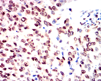DNMT1 Antibody