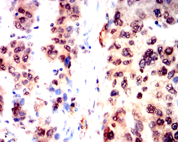 DNMT1 Antibody