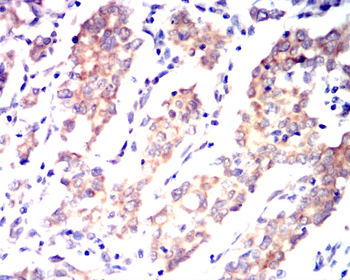 CREBBP Antibody