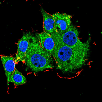 FABP4 Antibody