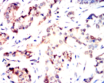 FABP4 Antibody