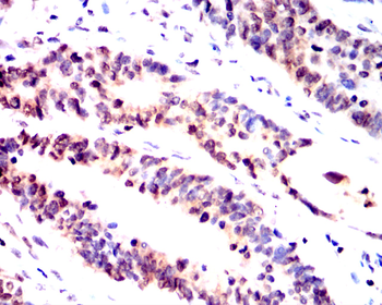 ATF3 Antibody