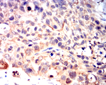 EIF5A Antibody
