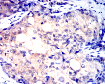 EIF5A Antibody