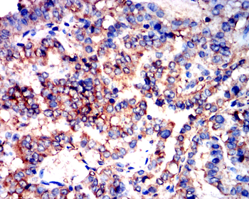 EIF5A Antibody