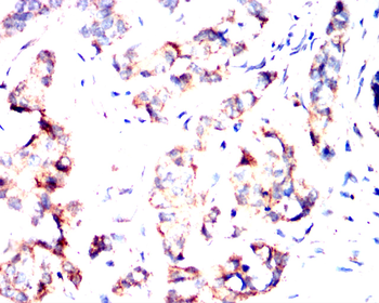 CTNNB1 Antibody
