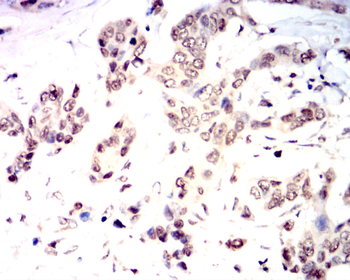 NOX4 Antibody