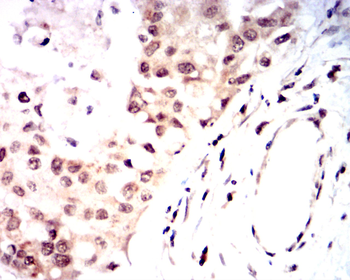 FST Antibody