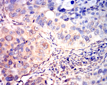 FST Antibody