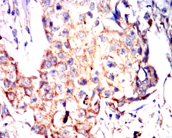 TERT Antibody