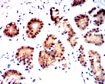 TERT Antibody