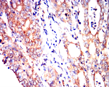 BAK1 Antibody