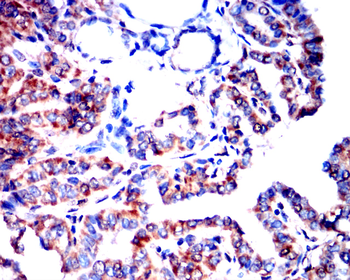 BAK1 Antibody