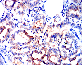 TGFB3 Antibody
