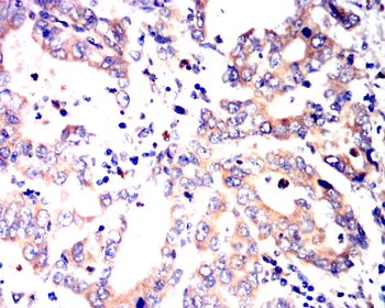 JAK3 Antibody