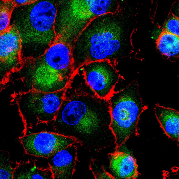 DNMT3A Antibody