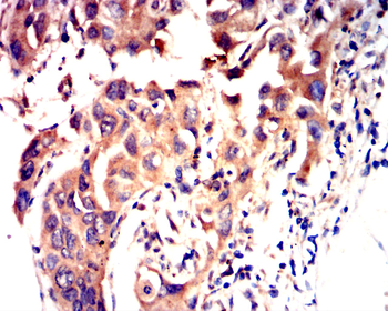 DNMT3A Antibody