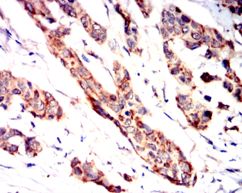 DNMT3A Antibody
