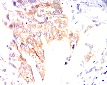 DNMT3A Antibody