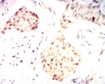 XRCC6 Antibody