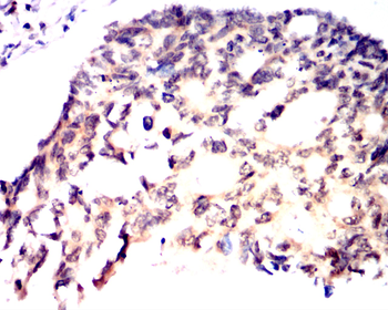 XRCC6 Antibody