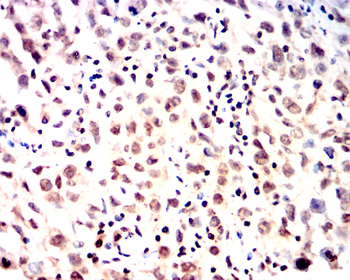 XRCC6 Antibody
