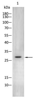 AQP5 Antibody