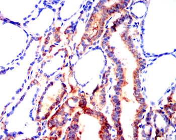 IRAK4 Antibody