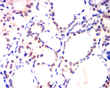 GATA1 Antibody