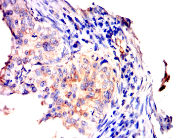 ALPP Antibody