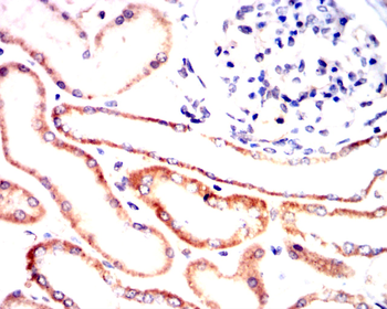 ALPP Antibody