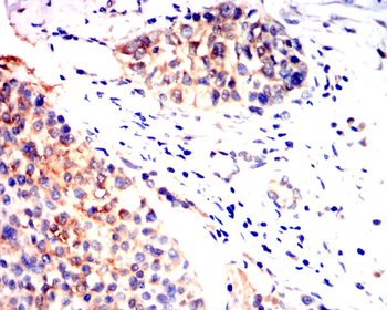 HK2 Antibody